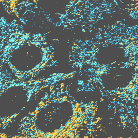 Aging Brain Cells
