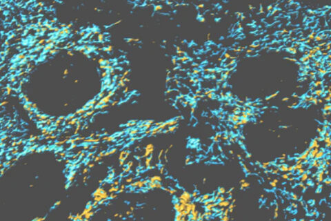Aging Brain Cells