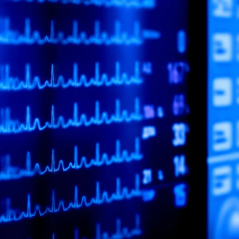 Influencing Blood Pressure monitor