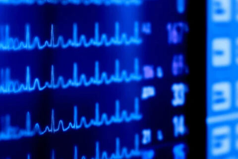 Heart monitor