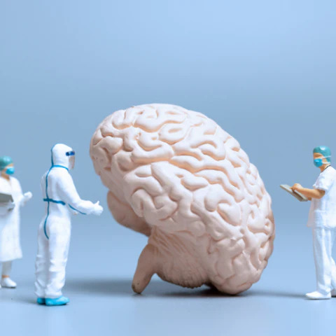 Doctors doing treatment on a brain