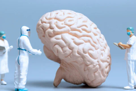 Doctors doing treatment on brain