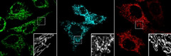 Aging Brain Cells
